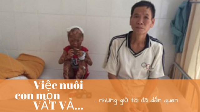 Mắc bệnh lạ bị mẹ bỏ rơi lúc mới sinh, 9 năm bé trai sống với người vừa làm ông vừa làm mẹ - 1