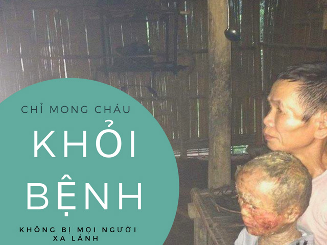 Mắc bệnh lạ bị mẹ bỏ rơi lúc mới sinh, 9 năm bé trai sống với người vừa làm ông vừa làm mẹ - 3