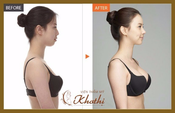 Áp dụng cách này giúp phái đẹp tăng size vòng một để diện bikini nóng bỏng - 4