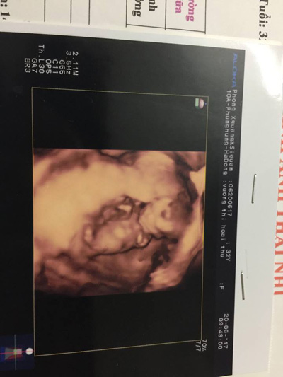 Hành trình 6 năm tìm con của cặp vợ chồng hiếm muộn - 4