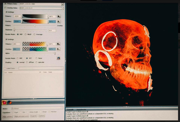 Xác ướp người phụ nữ kỳ lạ gần 1.000 năm trong băng giá vẫn còn nguyên da, tóc, lông mi - 3