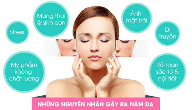 Laser Toning FFP – công nghệ amp;#34;thần thánhamp;#34; cứu cánh cho các chị em da nám - 2