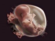 Bà bầu - Nằm trong số những bà mẹ này, bạn rất dễ sinh con dị tật