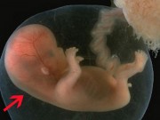 Bà bầu - Độ mờ da gáy thai nhi – những điều mẹ bầu nào cũng cần biết