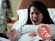 Bà bầu - Những thực phẩm giúp mẹ "vỡ chum" nhanh, không đau đớn
