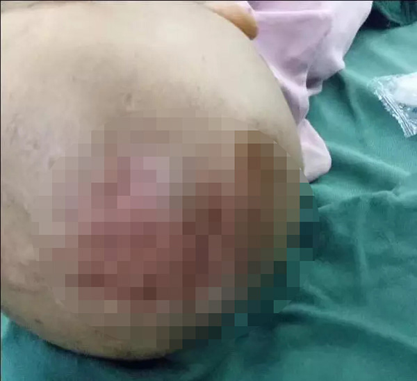 Bé gái 3 tuổi bị bỏng da đầu, kim đâm chi chít ở bụng từ những lần tra tấn dã man của mẹ kế - 1