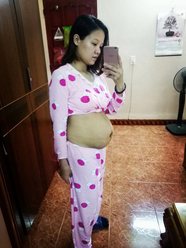 Vòng eo 10 ngày sau sinh “như chưa đẻamp;#34; của mẹ 9x khiến hội chị em còn son giật mình - 1