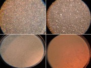 Làm mẹ - Cận cảnh chất lượng sữa mẹ, sữa bò và sữa công thức dưới kính hiển vi