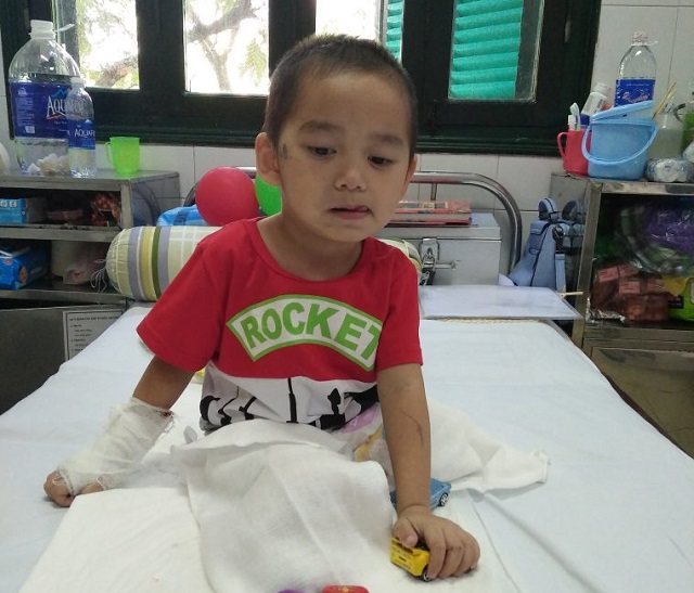 Nụ cười trở lại với cậu bé 4 tuổi mất 2 chân sau vụ sạt lở đất kinh hoàng ở Sơn La - 3