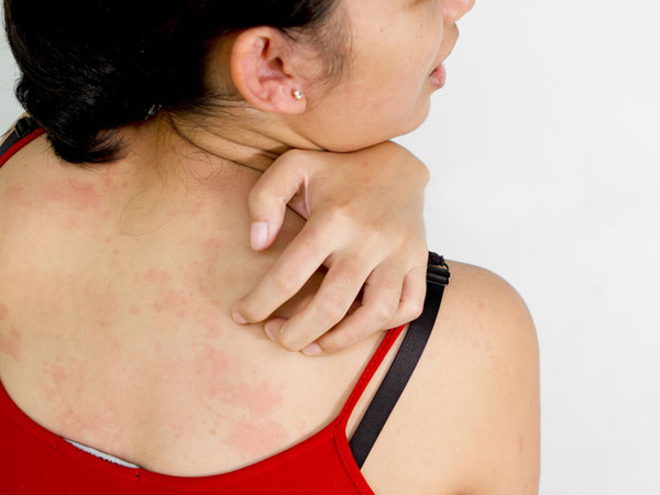 7 dấu hiệu ung thư da mà chúng ta không thể nhìn thấy bằng mắt thường - 2