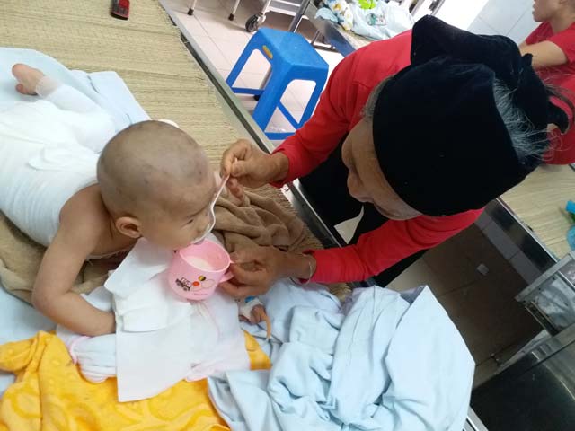 Con gái 16 tháng tuổi bị bỏng, mẹ bôi kem đánh răng làm mát nhận cái kết đau lòng - 3