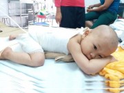 Tin tức - Con gái 16 tháng tuổi bị bỏng, mẹ bôi kem đánh răng làm mát nhận cái kết đau lòng