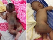 Làm mẹ - Con 6 tháng đen nhẻm tưởng đặc biệt, mẹ trẻ hoang mang sau khi khoe ảnh trên mạng