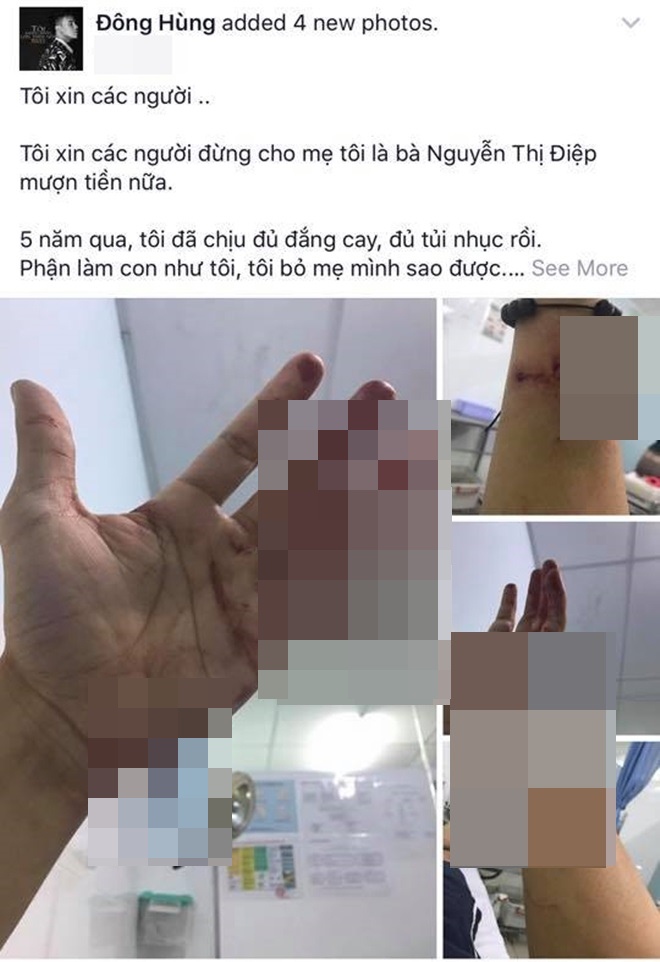 Nam ca sĩ bị chém: Từ công tử hào hoa đến chàng trai bán bún đậu mưu sinh - 5