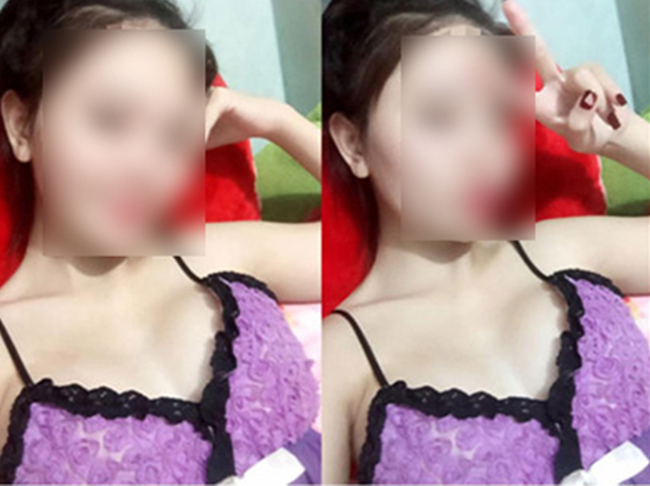 Tiết lộ nguyên nhân bất ngờ khiến thai phụ 22 tuổi tử vong sau khi nâng ngực - 1