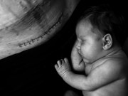 Bà bầu - Mẹ tự hào khoe bụng chằng chịt vết sẹo với thông điệp: "Để mổ không hề đáng xấu hổ"