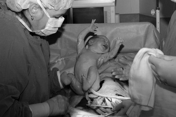 Mẹ đặt lịch mổ nhưng bé không chịu đợi, amp;#34;đòiamp;#34; ra đời vào ngày đặc biệt - 3