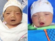 Bà bầu - Kỳ lạ em bé ở HN vừa chào đời đã có một chiếc răng, được ví như "miệng ngậm ngọc"