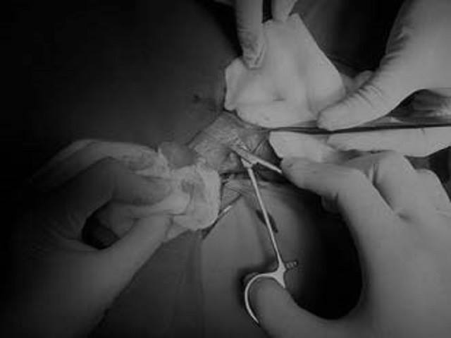 Dở khóc, dở cười với các pha tai nạn vợ đưa chồng vào viện vì “yêu” quá đà - 1