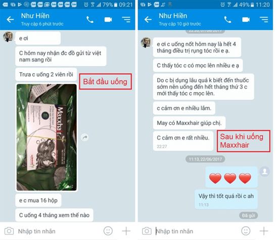 Mỗi ngày 5 phút thôi, tóc dù mỏng hay rụng nhiều cũng mọc lên ầm ầm - 4