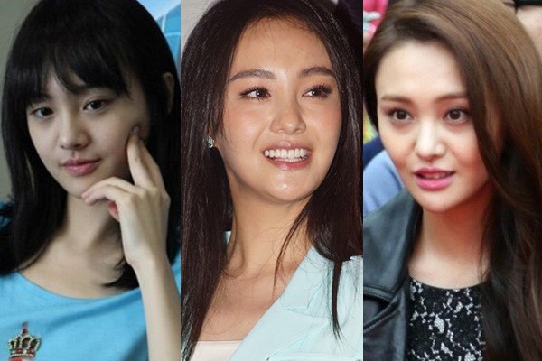 Phẫu thuật thẩm mỹ thất bại sao Hoa ngữ khổ cực tìm về nhan sắc ban đầu - 1