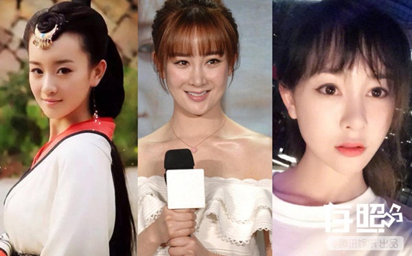 Phẫu thuật thẩm mỹ thất bại sao Hoa ngữ khổ cực tìm về nhan sắc ban đầu - 3