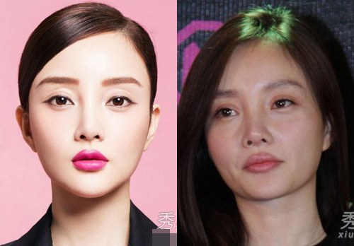 Phẫu thuật thẩm mỹ thất bại sao Hoa ngữ khổ cực tìm về nhan sắc ban đầu - 5