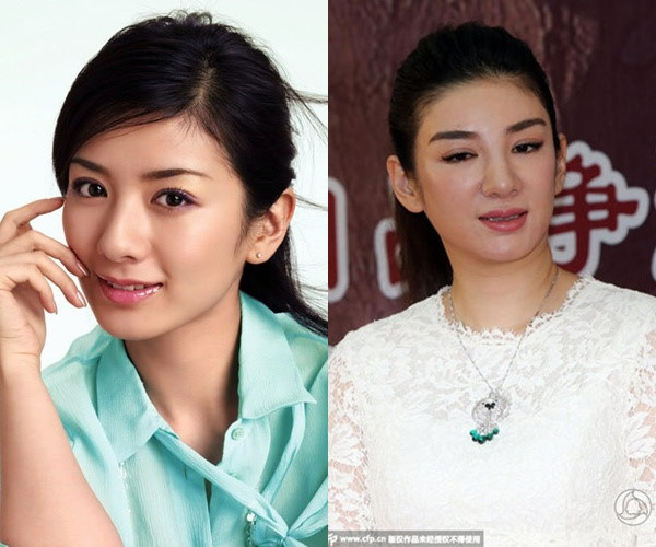 Phẫu thuật thẩm mỹ thất bại sao Hoa ngữ khổ cực tìm về nhan sắc ban đầu - 7