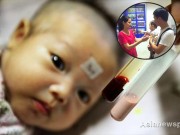 Làm mẹ - Bệnh tan máu bẩm sinh ở trẻ em là gì?