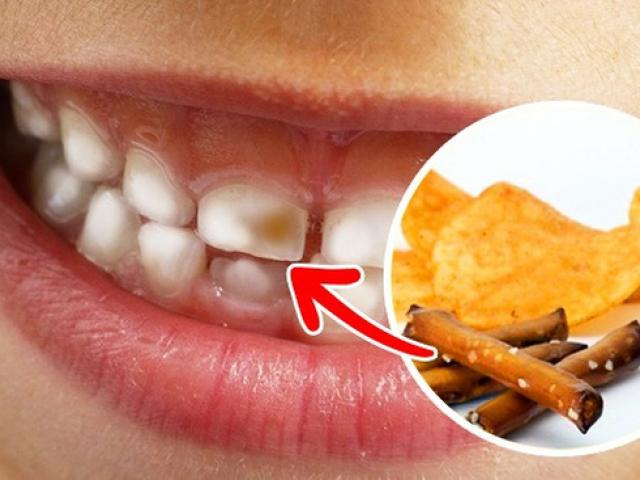 9 loại thực phẩm hay ăn hằng ngày có hại cho răng ít người biết
