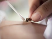 Nuôi con - Trình tự vệ sinh cuống rốn cho trẻ sơ sinh để không bị nhiễm trùng huyết