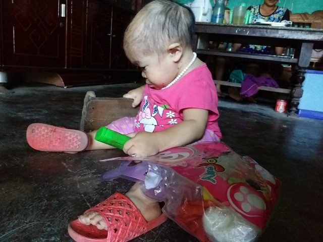 Cô gái 9X mang hình hài đứa trẻ lên 2, nuôi hơn 20 năm mãi không thể lớn - 1