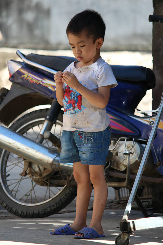 Cô gái 9X mang hình hài đứa trẻ lên 2, nuôi hơn 20 năm mãi không thể lớn - 10