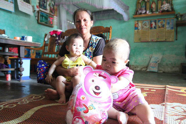 Cô gái 9X mang hình hài đứa trẻ lên 2, nuôi hơn 20 năm mãi không thể lớn - 8