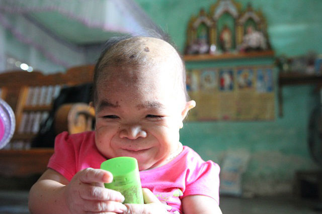 Cô gái 9X mang hình hài đứa trẻ lên 2, nuôi hơn 20 năm mãi không thể lớn - 7