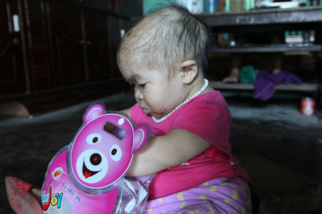 Cô gái 9X mang hình hài đứa trẻ lên 2, nuôi hơn 20 năm mãi không thể lớn - 9