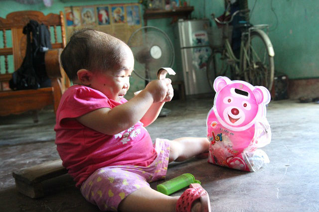 Cô gái 9X mang hình hài đứa trẻ lên 2, nuôi hơn 20 năm mãi không thể lớn - 4