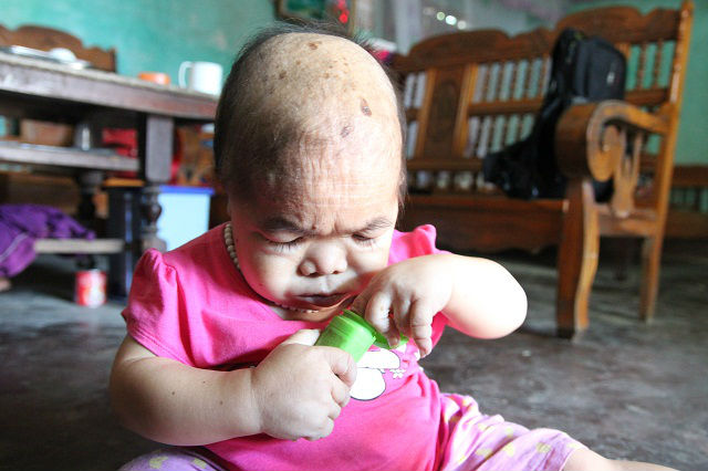 Cô gái 9X mang hình hài đứa trẻ lên 2, nuôi hơn 20 năm mãi không thể lớn - 5