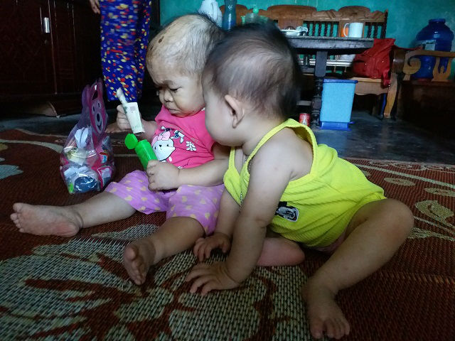 Cô gái 9X mang hình hài đứa trẻ lên 2, nuôi hơn 20 năm mãi không thể lớn - 6