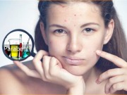 Làm đẹp - Hóa chất trong mỹ phẩm “hủy hoại” cơ thể bạn như thế nào?