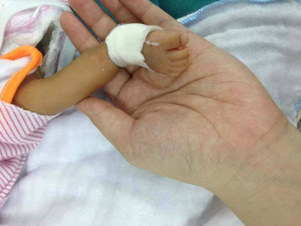 Hà Nội: Người mẹ trẻ bỏ rơi con sinh non 1,4kg lại bệnh viện - 2