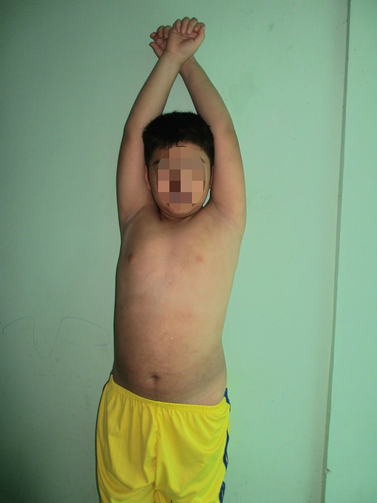 Người mẹ bạo hành con trai 9 tuổi nhập viện lên tiếng - 2