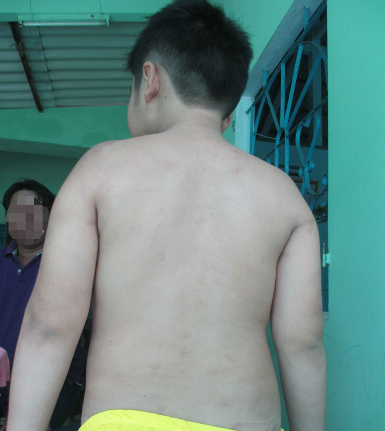 Người mẹ bạo hành con trai 9 tuổi nhập viện lên tiếng - 3