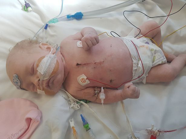 Thai nhi chỉ có nửa trái tim, bà mẹ vẫn quyết sinh con và điều kỳ diệu đã đến - 1