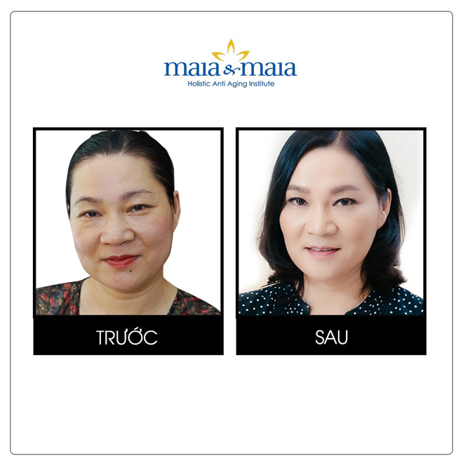 Collagen – nhiều cường điệu nhưng lại ít bằng chứng? - 5