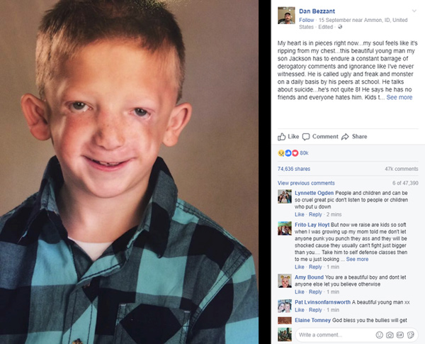 Con trai bị bắt nạt ở trường định tự tử, lời nói của ông bố khiến nghìn người tâm phục - 3