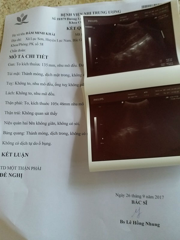 Bé trai 10 tuổi, nặng 14kg ăn mãi không no vì có “hệ tiêu hóa” để ngoài da - 2