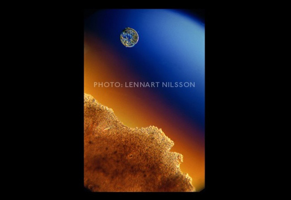 Bao năm rồi nhưng đây vẫn là bộ ảnh xuất sắc nhất về thai nhi trong bụng mẹ - 10