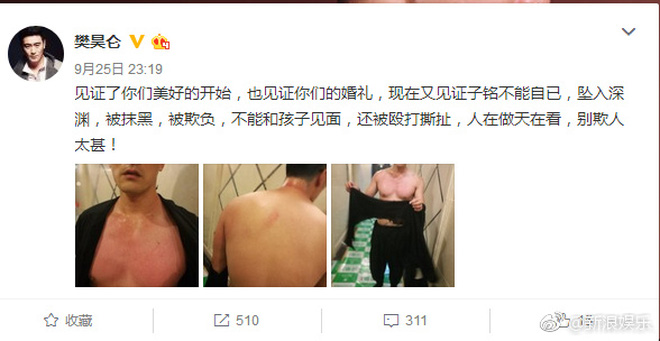 Ngôi sao 24/7: Ngắm Jang Dong Gun của 10 năm về trước, ai cũng hiểu tại sao anh nổi tiếng - 7