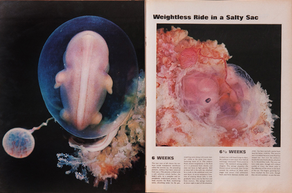 Bao năm rồi nhưng đây vẫn là bộ ảnh xuất sắc nhất về thai nhi trong bụng mẹ - 4